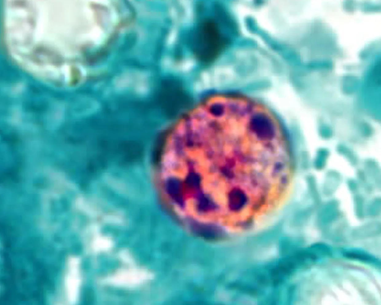 Cyclospora CP Shome